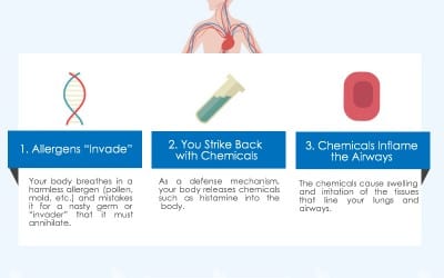 [infographic] Allergy-Induced Asthma